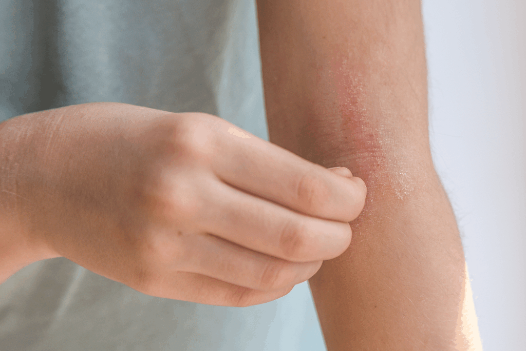 Girl scratching eczema spot on her arm.